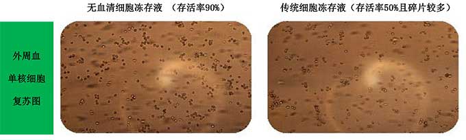 無血清細胞凍存液凍存單個核細胞.jpg