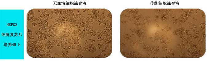 無血清細胞凍存液凍存HEPG2細胞.jpg