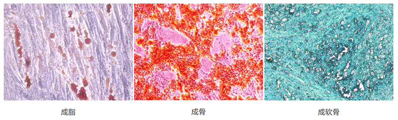 干細(xì)胞三系分化.png